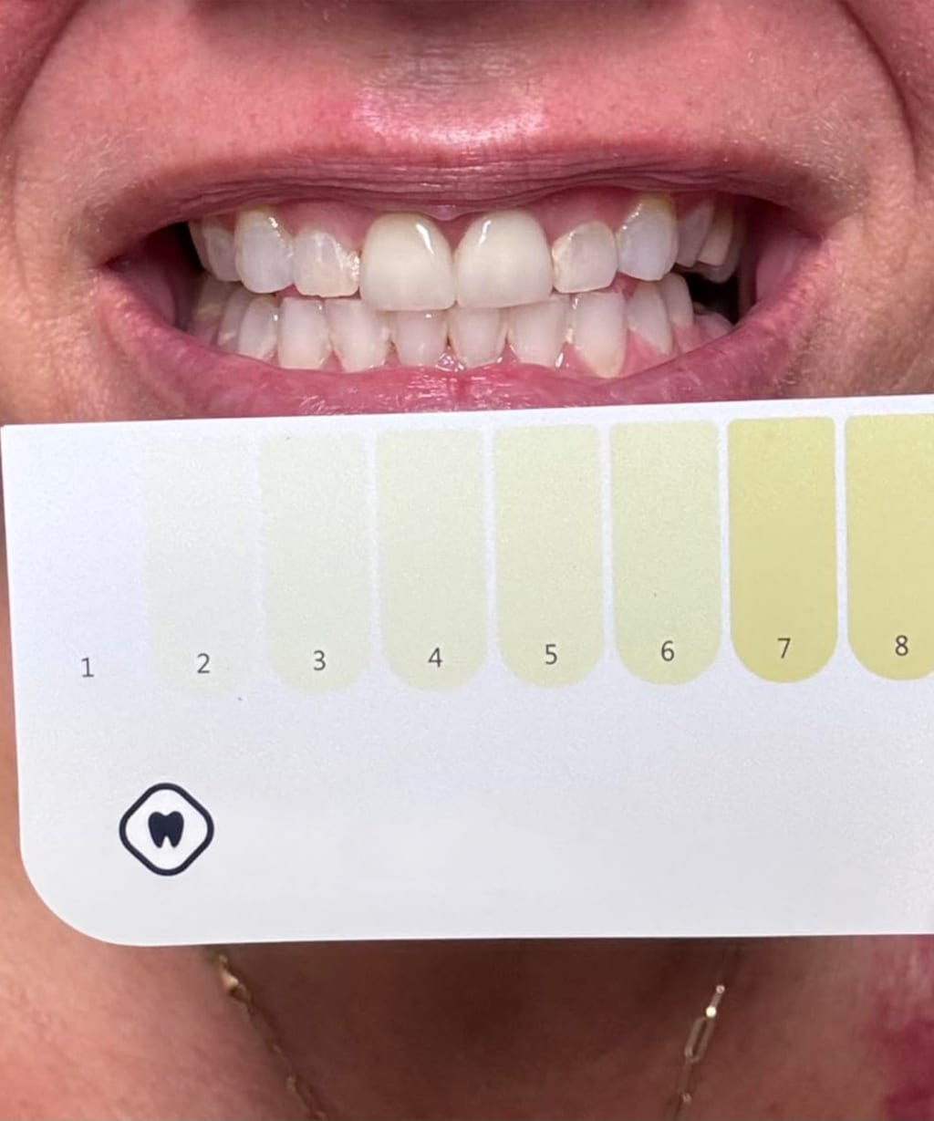 Purple Teeth Whitening Strips Oral Hygiene Fresh Breath Brighten Tooth Bleaching Long Lasting Oral Care Tooth Whitener Patches